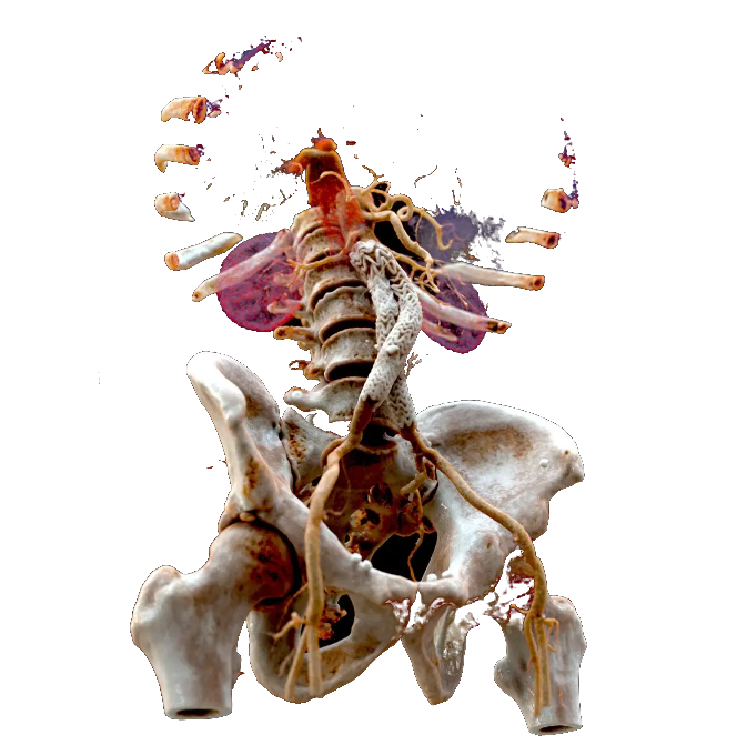 Medical Imaging